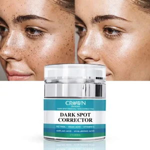Pigment Lightening Moisturizer Face Cream for Melasma, Freckles, and Dark Spots